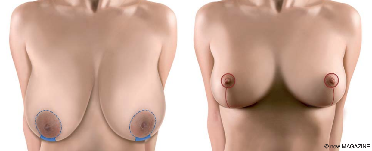 raffaele merola chirurgo estetico