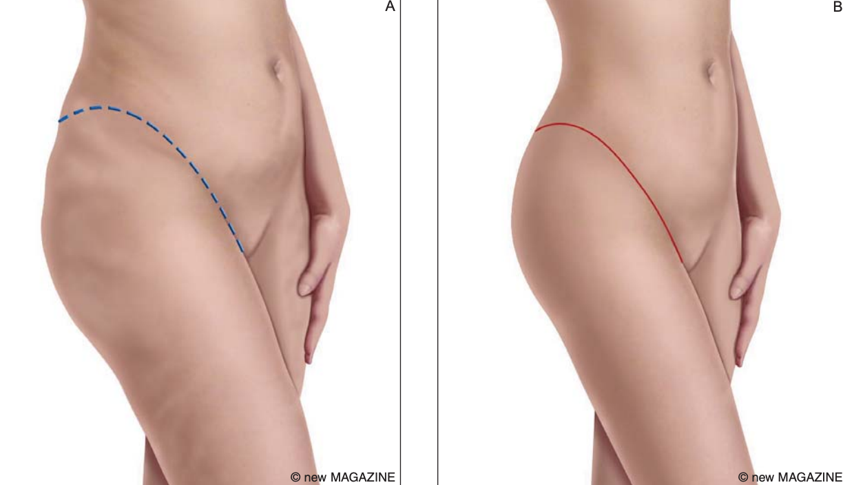 raffaele merola chirurgo estetico