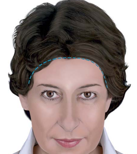 raffaele merola chirurgo estetico