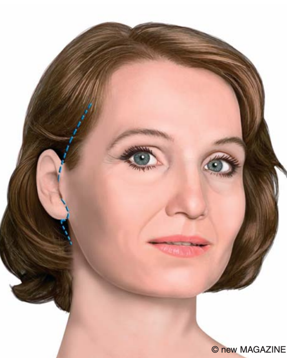 raffaele merola chirurgo estetico