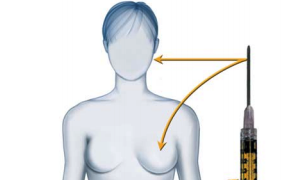 raffaele merola chirurgo estetico