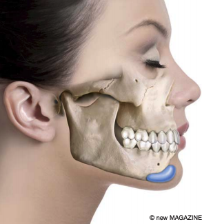 raffaele merola chirurgo estetico