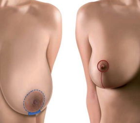 raffaele merola chirurgo estetico